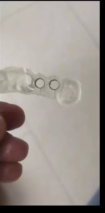 Resin Dental 3D Printer Planti - 3D Printing Uv Resin 评论和价格